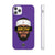 Anthony Davis Phone Cases - The Brow Limited Edition